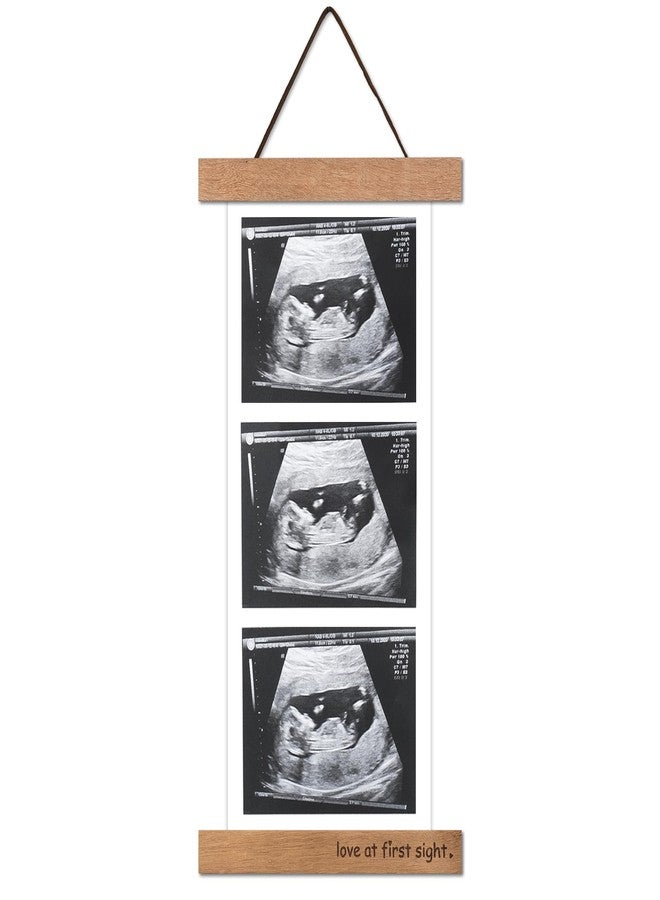 Zyeco Magnetic Ultrasound Photo Frame, Wooden Baby Keepsake Display with Love at First Sight, Hanging or Fridge Mount - No Crop Needed for Long Sonograms, new mom gifts - Image 1